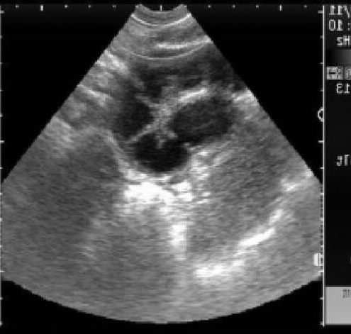 犬子宫蓄脓的B超影像学诊断